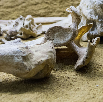 Human bone